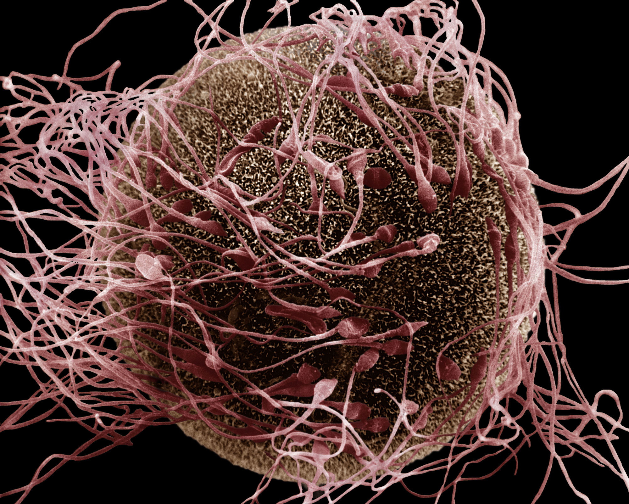 Human Spermatozoa Fertilizing An Egg Alberto Dell Isola